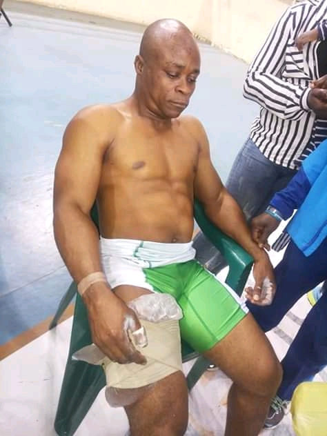 CR Gold Medalist At The 2018 National Sports Festival Sustains Injury